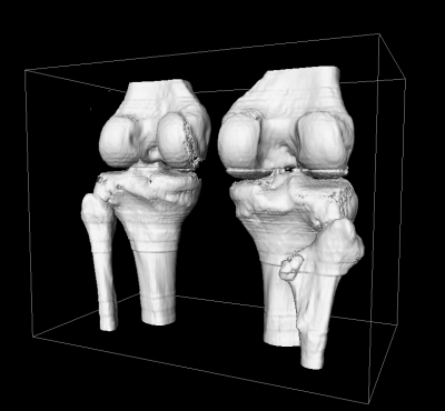 CT of knee, filtered, k-flat hyperconnectivity, isosurface at level 1