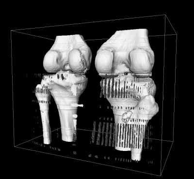 CT of knee, filtered, standard connectivity, isosurface at level 1