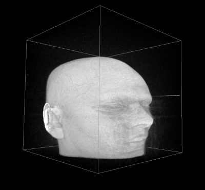 MRI of head, original, isosurface at level 1