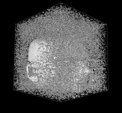 MRI of head, filtered, standard connectivity , isosurface at level 1